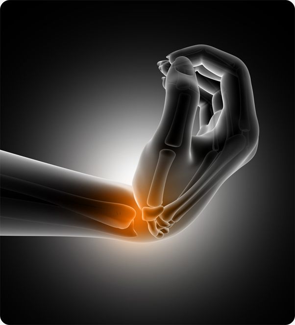 Illustration of a wrist joint highlighted in pain